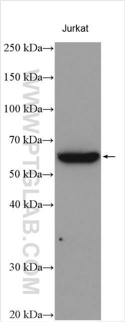 Calpain 10 Rabbit Polyclonal Antibody, Proteintech Unconjugated; 150 &mu;L:Antibodies,