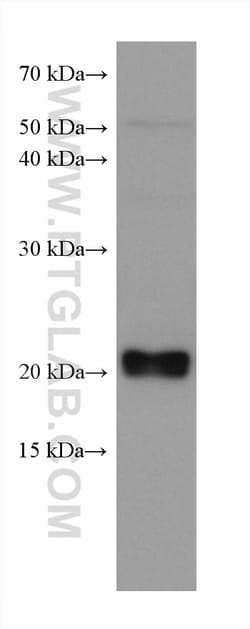 CBFB Mouse Monoclonal Antibody, Proteintech 150 &mu;L | Buy Online | Proteintech | Fisher Scientific