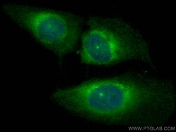 CCDC18 Rabbit Polyclonal Antibody, Proteintech:Antibodies:Primary Antibodies