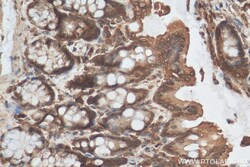 CCDC18 Rabbit Polyclonal Antibody, Proteintech:Antibodies:Primary Antibodies
