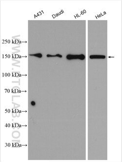 CCDC18 Rabbit Polyclonal Antibody, Proteintech:Antibodies:Primary Antibodies