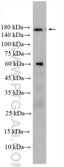 CCDC88B Rabbit Polyclonal Antibody, Proteintech Unconjugated; 20 &mu;L:Antibodies,