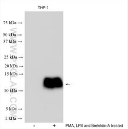 CCL3L1 Rabbit Polyclonal Antibody, Proteintech Unconjugated; 20 &mu;L:Antibodies,