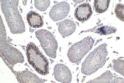 Cyclin A1 Rabbit Polyclonal Antibody, Proteintech Unconjugated; 20 &mu;L:Antibodies,