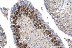 Cyclin A1 Rabbit Polyclonal Antibody, Proteintech Unconjugated; 20 &mu;L:Antibodies,