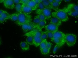 Cyclin B2 Mouse Monoclonal Antibody, Proteintech Unconjugated; 150 &mu;L:Antibodies,