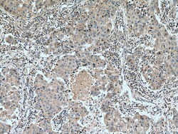 Cyclin B2 Mouse Monoclonal Antibody, Proteintech Unconjugated; 150 &mu;L:Antibodies,