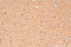 CCS Mouse Monoclonal Antibody, Proteintech Unconjugated; 150 &mu;L:Antibodies,
