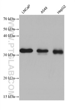 CCS Mouse Monoclonal Antibody, Proteintech Unconjugated; 150 &mu;L:Antibodies,