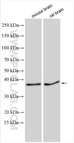 CCSAP Rabbit Polyclonal Antibody, Proteintech Unconjugated; 20 &mu;L:Anticuerpos