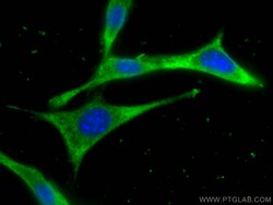 CCT2 Mouse Monoclonal Antibody, Proteintech Unconjugated; 150 &mu;L:Antibodies,