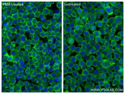 CD11c/Integrin alpha X Rabbit Recombinant Antibody, Proteintech Unconjugated;
