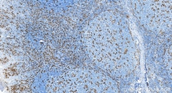 CD11c/Integrin alpha X Rabbit Recombinant Antibody, Proteintech Unconjugated;