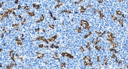 CD11c/Integrin alpha X Rabbit Recombinant Antibody, Proteintech Unconjugated;