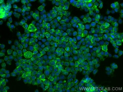 Anti-Human CD13 (WM15), Proteintech Unconjugated; 500 &mu;g:Antibodies,