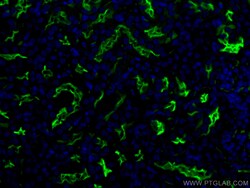 CoraLite Plus 488-conjugated CD133 Rabbit Polyclonal Antibody, Proteintech:Antibodies:Primary