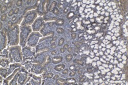 CD151 Rabbit Polyclonal Antibody, Proteintech:Antibodies:Primary Antibodies
