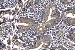 CD151 Rabbit Polyclonal Antibody, Proteintech:Antibodies:Primary Antibodies