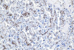 CD163 Mouse Monoclonal Antibody, Proteintech Unconjugated; 20 &mu;L:Antibodies,