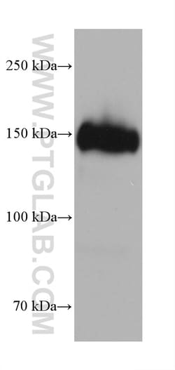 CD163 Mouse Monoclonal Antibody, Proteintech Unconjugated; 20 &mu;L:Antibodies,