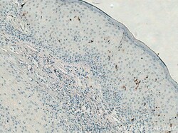 CD207 Mouse Monoclonal Antibody, Proteintech Unconjugated; 150 &mu;L:Antibodies,