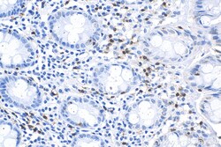CD3 Rabbit Recombinant Antibody, Proteintech:Antibodies:Primary Antibodies