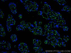 CoraLite Plus 488-conjugated CD31 Mouse Monoclonal Antibody, Proteintech 20 &mu;L | Buy Online | Proteintech | Fisher Scientific