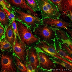 CoraLite Plus 488-conjugated CD31 Mouse Monoclonal Antibody, Proteintech 20 &mu;L | Buy Online | Proteintech | Fisher Scientific