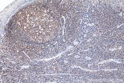 CD45 Rabbit Polyclonal Antibody, Proteintech:Antibodies:Primary Antibodies