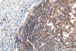 CD45 Rabbit Polyclonal Antibody, Proteintech:Antibodies:Primary Antibodies