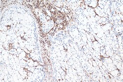 CD45 Rabbit Polyclonal Antibody, Proteintech:Antibodies:Primary Antibodies