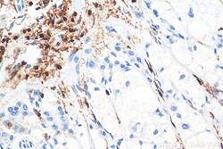 CD45 Rabbit Polyclonal Antibody, Proteintech:Antibodies:Primary Antibodies