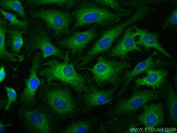 CD46 Rabbit Polyclonal Antibody, Proteintech:Antibodies:Primary Antibodies