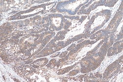 CD46 Rabbit Polyclonal Antibody, Proteintech:Antibodies:Primary Antibodies