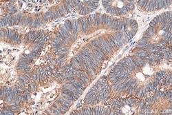 CD46 Rabbit Polyclonal Antibody, Proteintech:Antibodies:Primary Antibodies