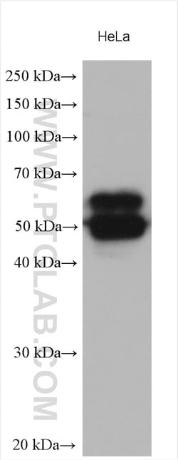 CD46 Rabbit Polyclonal Antibody, Proteintech:Antibodies:Primary Antibodies