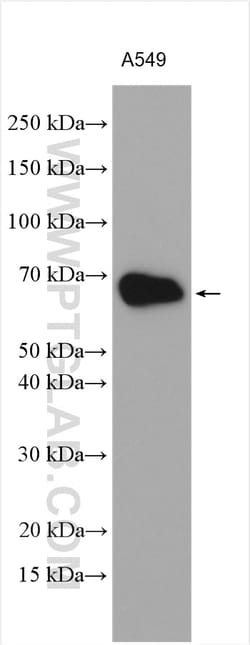 CD46 Rabbit Polyclonal Antibody, Proteintech:Antibodies:Primary Antibodies