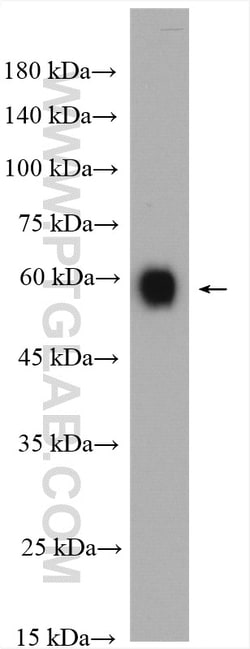 CD46 Rabbit Polyclonal Antibody, Proteintech:Antibodies:Primary Antibodies