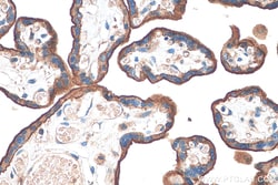 CD59 Rabbit Polyclonal Antibody, Proteintech 150 &mu;L | Buy Online | Proteintech | Fisher Scientific