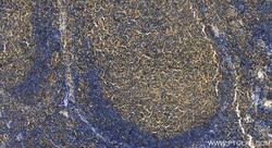 CD59 Rabbit Polyclonal Antibody, Proteintech 150 &mu;L | Buy Online | Proteintech | Fisher Scientific