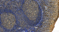 CD59 Rabbit Polyclonal Antibody, Proteintech 150 &mu;L | Buy Online | Proteintech | Fisher Scientific