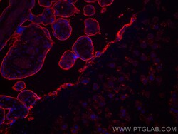CD59 Mouse Monoclonal Antibody, Proteintech:Antibodies:Primary Antibodies