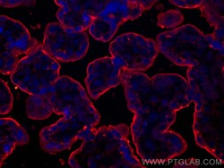 CD59 Mouse Monoclonal Antibody, Proteintech:Antibodies:Primary Antibodies
