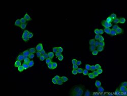 CD59 Mouse Monoclonal Antibody, Proteintech:Antibodies:Primary Antibodies