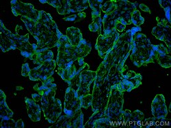 CD59 Mouse Monoclonal Antibody, Proteintech:Antibodies:Primary Antibodies