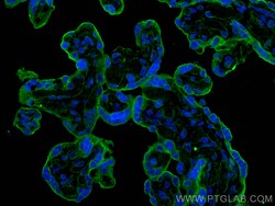 CD59 Mouse Monoclonal Antibody, Proteintech:Antibodies:Primary Antibodies