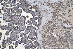 CD59 Mouse Monoclonal Antibody, Proteintech:Antibodies:Primary Antibodies