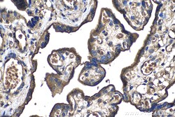 CD59 Mouse Monoclonal Antibody, Proteintech:Antibodies:Primary Antibodies