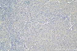 CD59 Mouse Monoclonal Antibody, Proteintech:Antibodies:Primary Antibodies