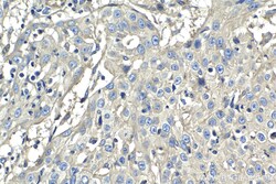 CD59 Mouse Monoclonal Antibody, Proteintech:Antibodies:Primary Antibodies